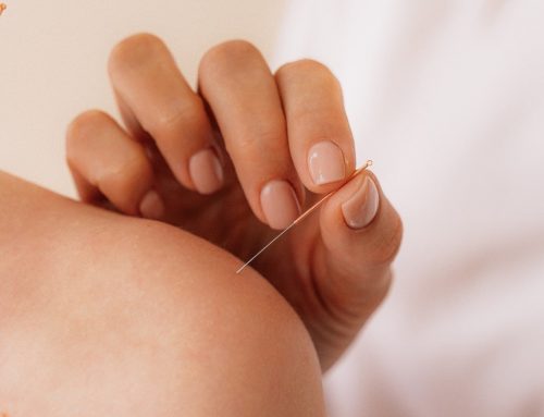 Dry Needling for Patients Afraid of Needles